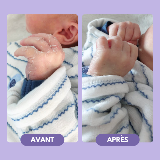 Moisturizing Body Lotion - BODY NECTAR - Babyzz