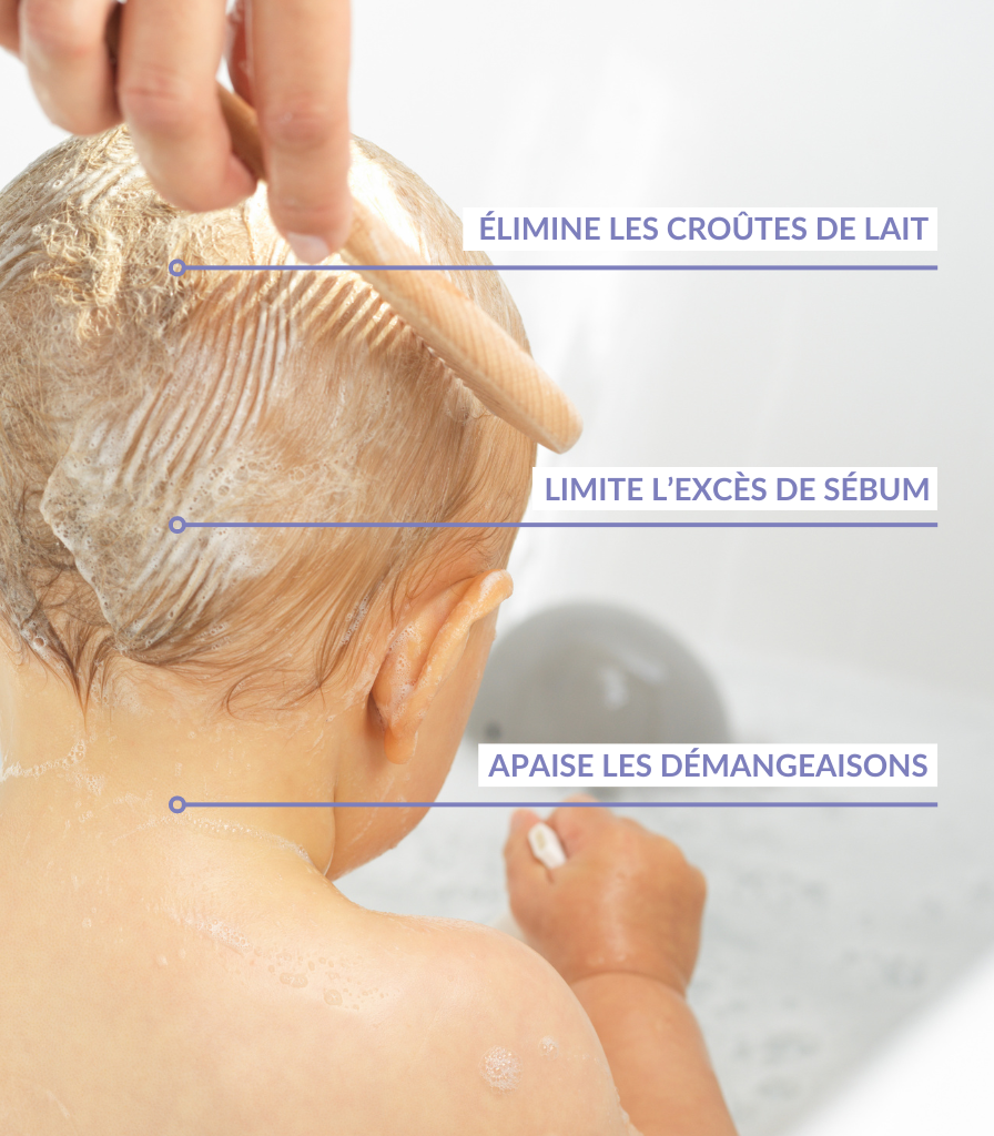 Anti-Cradle Cap Shampoo - Babyzz