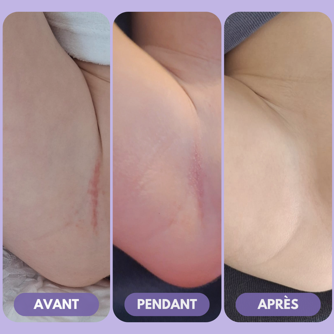 Nappy cream for changing - HONEY BALM - Babyzz