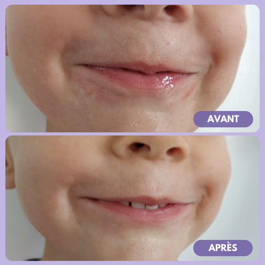 Crème Visage Douceur - MELICREAM - Babyzz