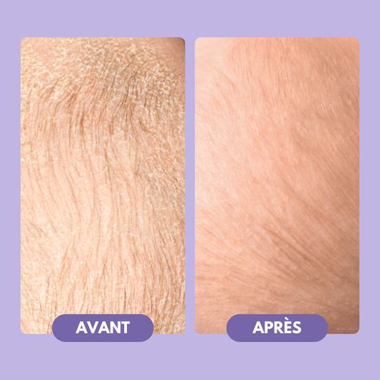 Duo Douceur - Shampoing anti-croûtes & Brosse Bébé